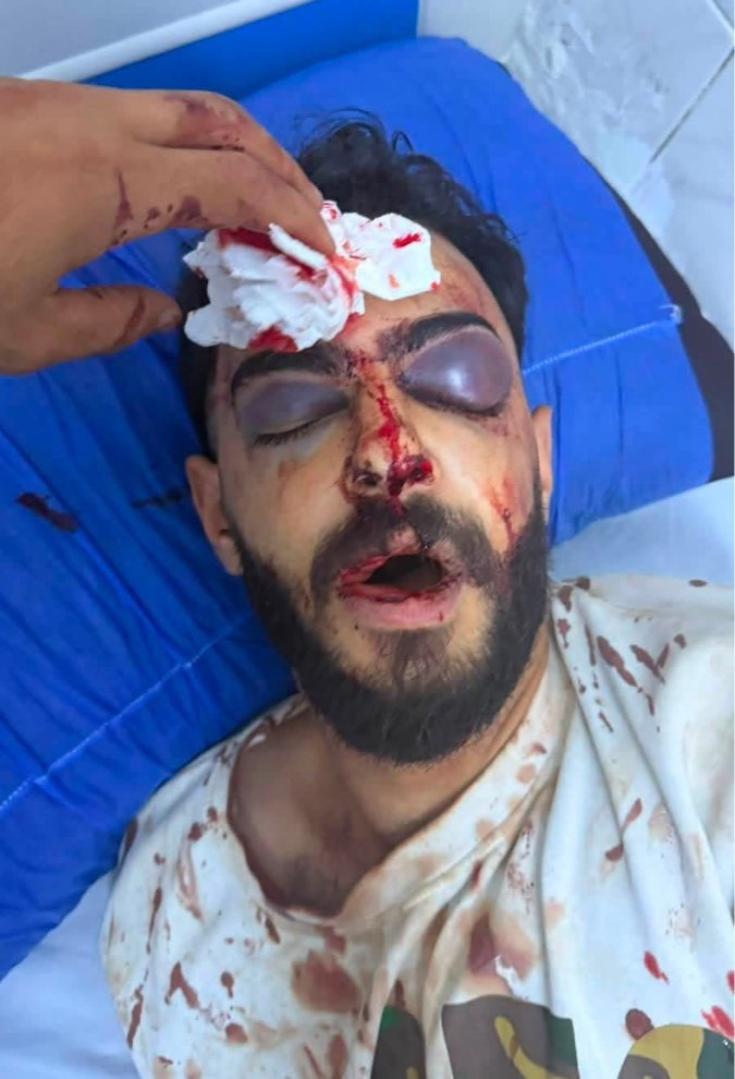 شاب يصارع الموت بعد واقعة اعتداء داخل كافيه بـ الحوامدية.. وأسرته تناشد بسرعة تحقيق العدالة وكشف الحقيقة